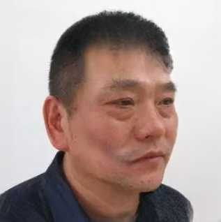 去眼袋手术