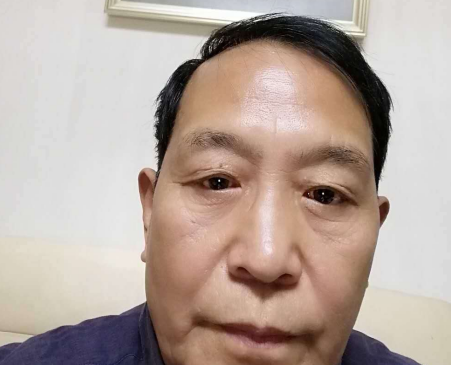 去眼袋手术