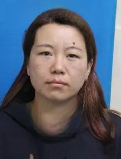 去眼袋手术