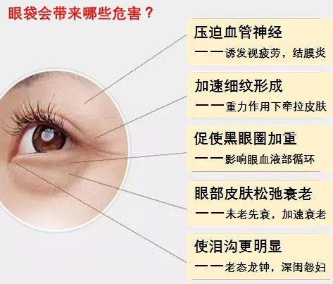 去眼袋手术