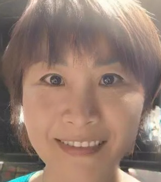 去眼袋手术