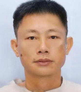 去眼袋手术
