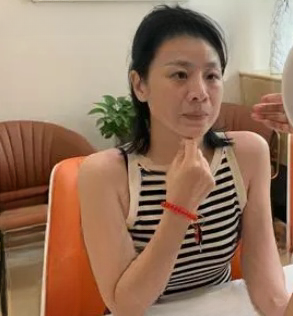 去眼袋手术