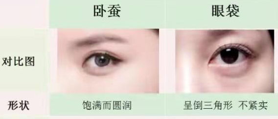 去眼袋手术
