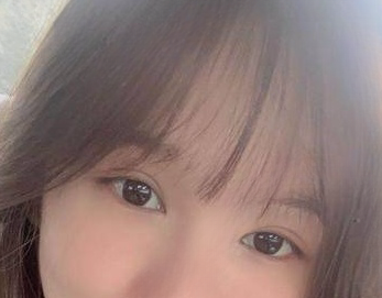 去眼袋手术