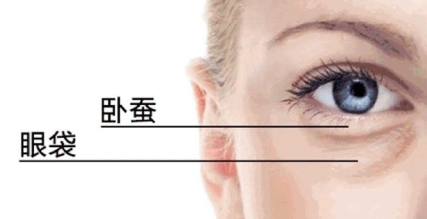 去眼袋手术