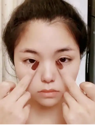 眼袋