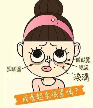 去眼袋手术