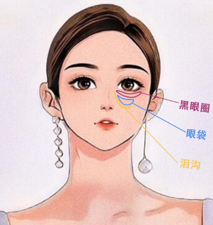 眼袋