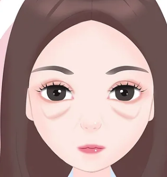 去眼袋手术