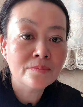去眼袋手术