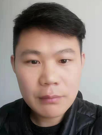 去眼袋手术