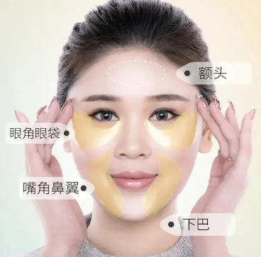 去眼袋手术