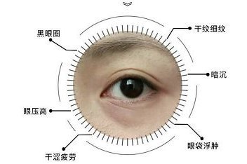 去眼袋手术
