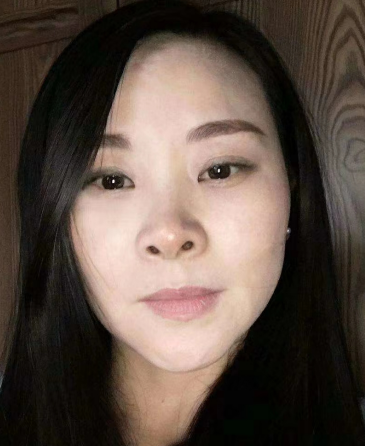 去眼袋手术