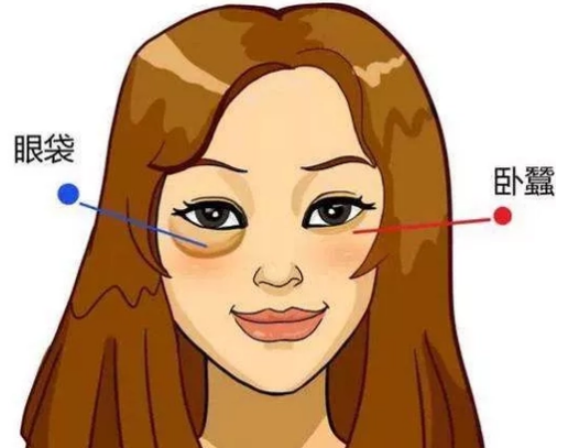 去眼袋手术