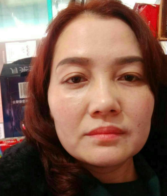 去眼袋手术