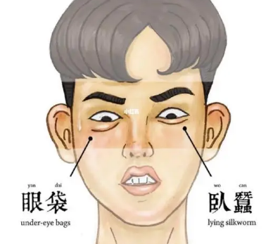去眼袋手术