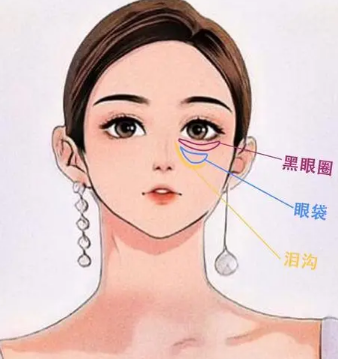 去眼袋手术