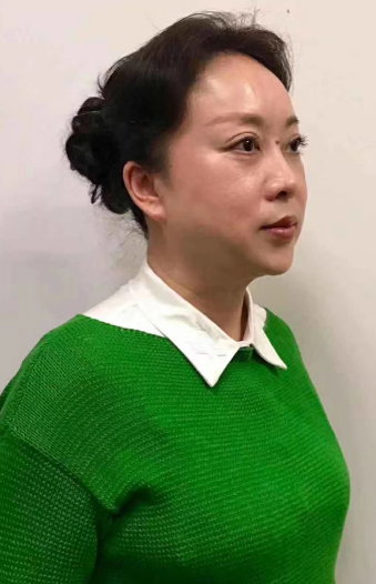 去眼袋手术