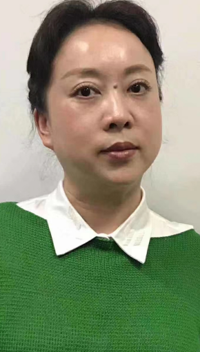 去眼袋手术