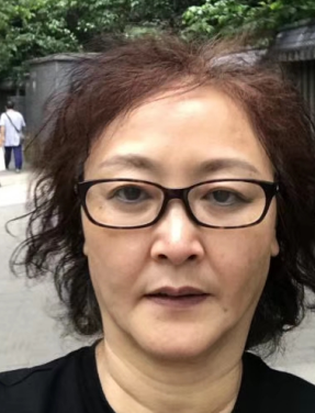 去眼袋手术