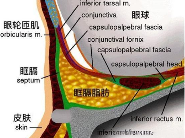 去眼袋手术
