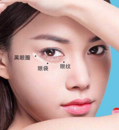去眼袋手术