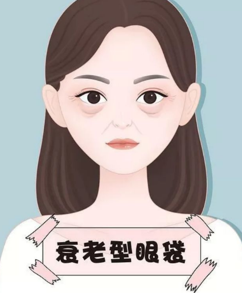 去眼袋手术