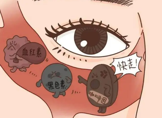去眼袋手术
