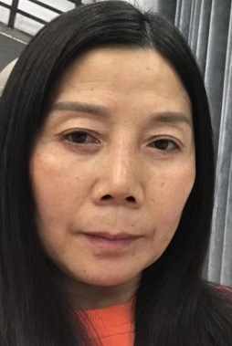 去眼袋手术
