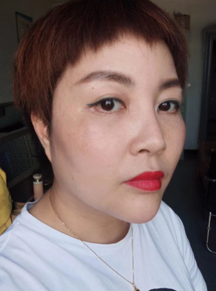 去眼袋手术