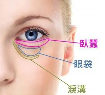 去眼袋手术