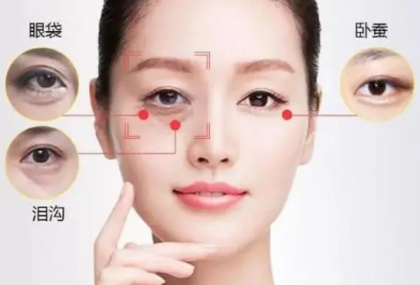 去眼袋手术