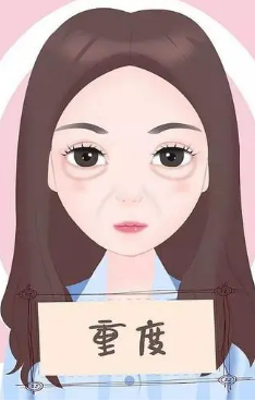 去眼袋手术
