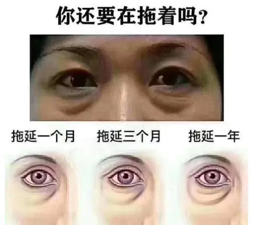 去眼袋手术