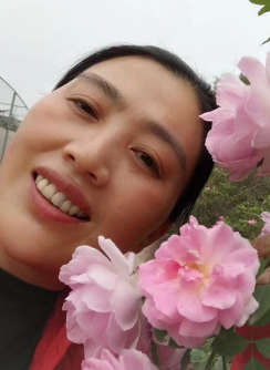 去眼袋手术