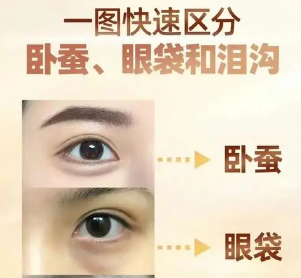 去眼袋手术