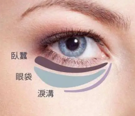 眼袋