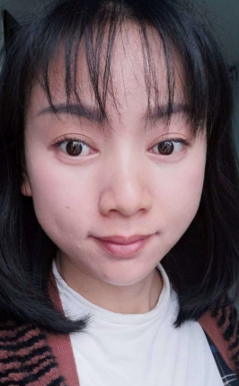 去眼袋手术