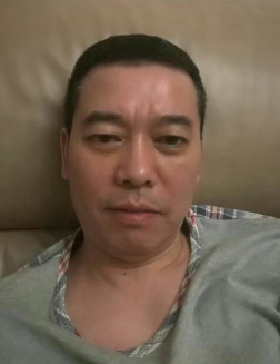 去眼袋手术