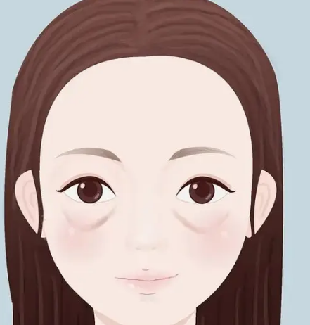 去眼袋手术
