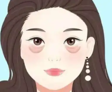 去眼袋手术