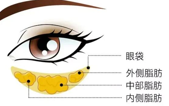 眼袋