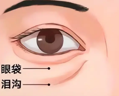 眼袋