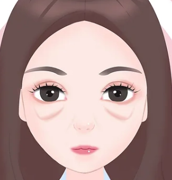 眼袋