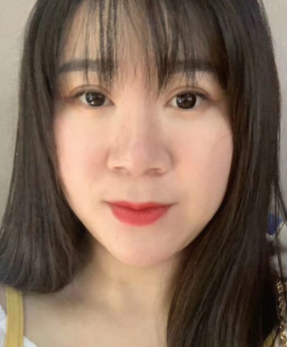 去眼袋手术