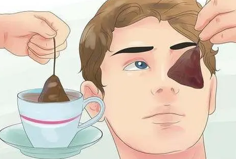 去眼袋手术