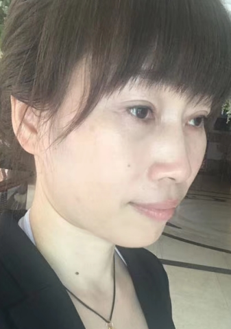 去眼袋手术