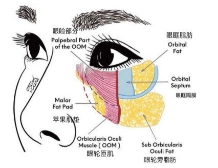 去眼袋手术